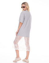 שמלת טישרט תחרה