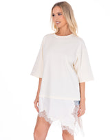 טוניקה שילוב תחרה