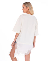 טוניקה שילוב תחרה