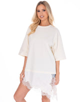 טוניקה שילוב תחרה